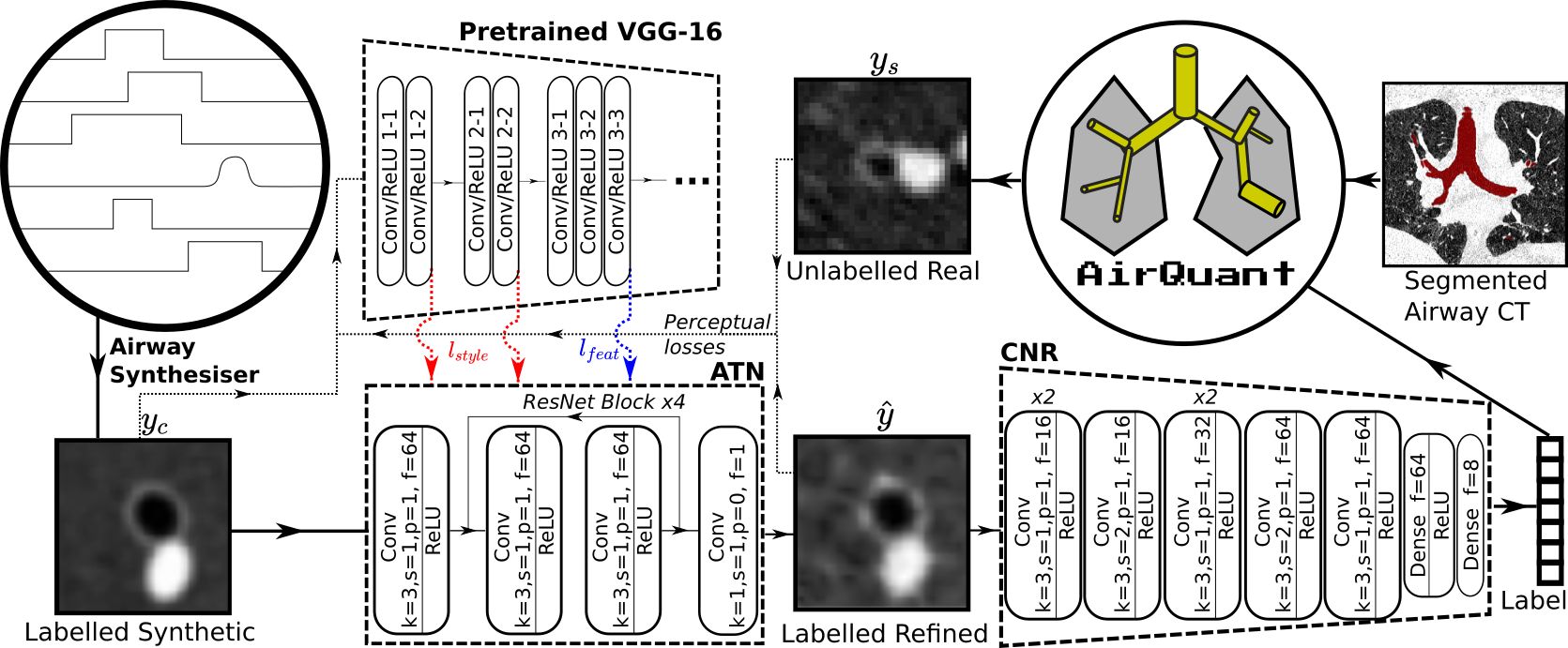 Airway measurement by refinement of synthetic images improves mortality ...
