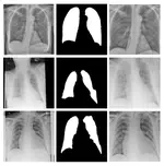 Optimising Chest X-Rays for Image Analysis by Identifying and Removing Confounding Factors