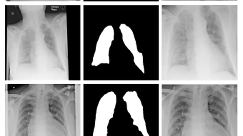 Optimising Chest X-Rays for Image Analysis by Identifying and Removing Confounding Factors